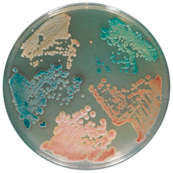 Cреда для выделения и дифференциации Candida Spp | Candida 5000 мл CHROMagar