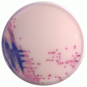 Enterococcus (VRE.faecalis и VRE.faecium) | CHROMagar™ VRE CHROMagar