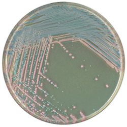 Среда для выделения Staphylococcus aureus | CHROMagar™ Staph aureus 1000 мл CHROMagar