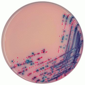 Rambach™ Agar — первая хромогенная среда для обнаружения сальмонеллы CHROMagar