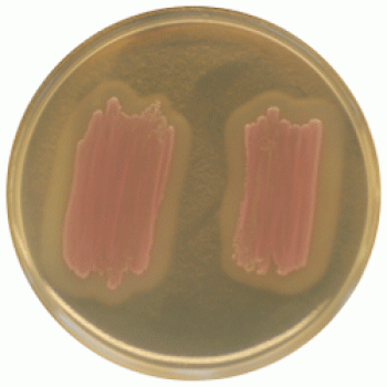 Cреда для идентификации L. monocytogenes | CHROMagar™ Identification Listeria CHROMagar