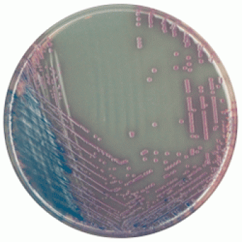 Cреда для выделения Salmonella | CHROMagar™ Salmonella 1000 мл CHROMagar